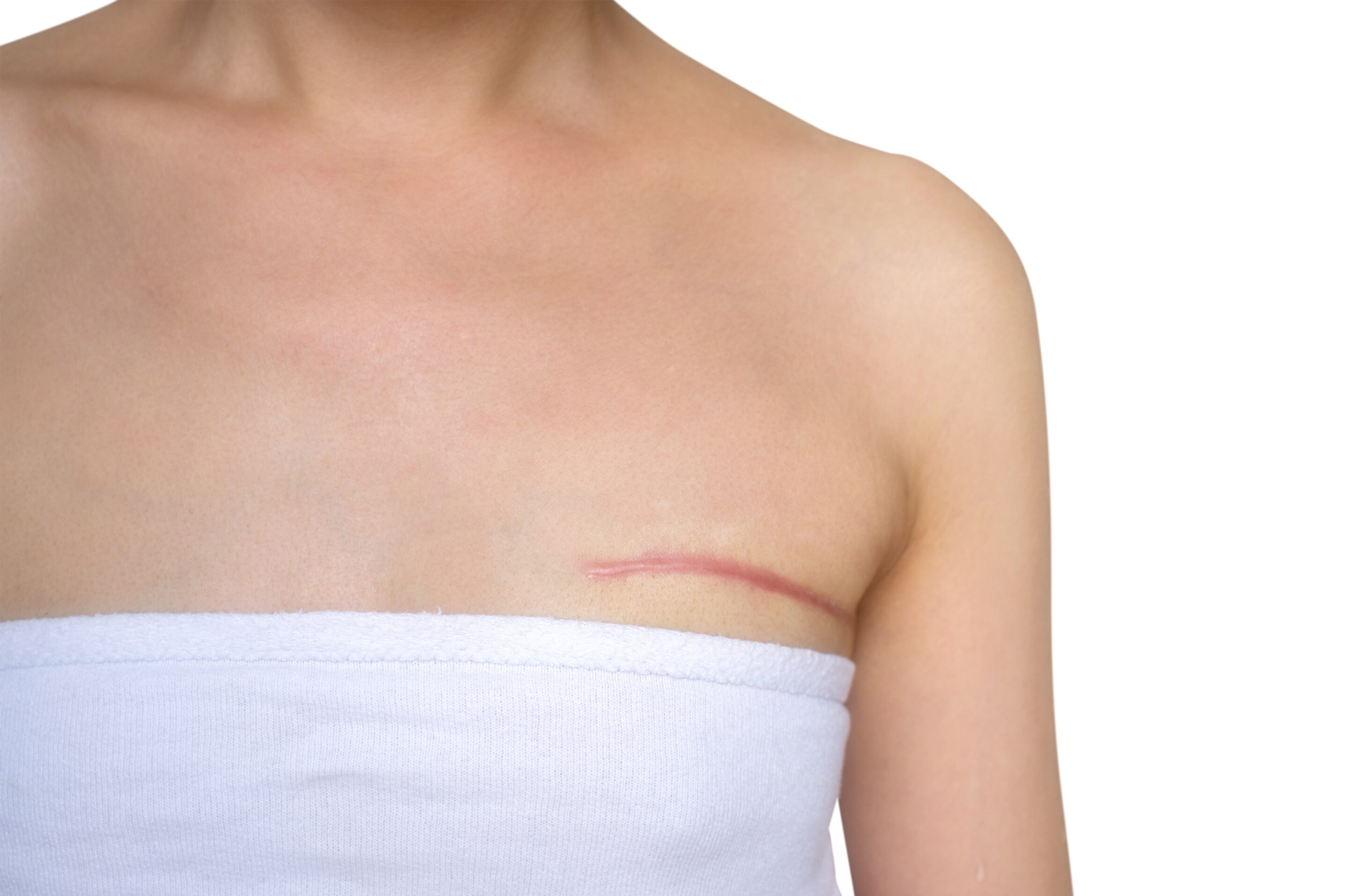 Do you like the Women’s Health subject? Then take a look at the course coming up in September about Scars and Adhesions & breast cancer with Susan Chapelle!