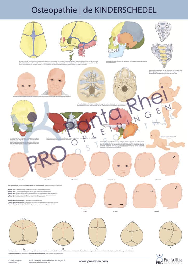 Poster Osteopathie bij kinderen | de Schedel